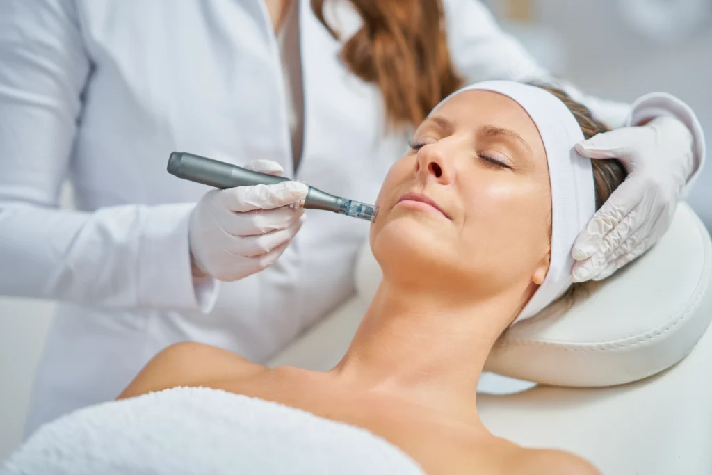 Esteticista haciendo tratamiento con dermapen