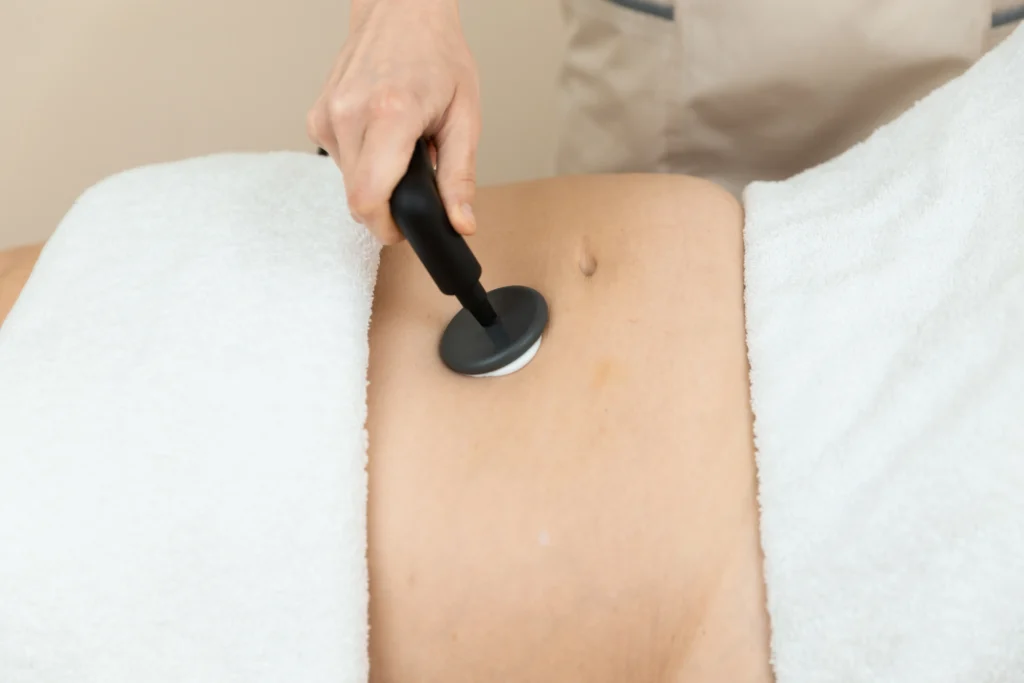 Radiofrecuencia en el abdomen